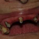 DSCF0032