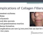 a.soft-tissue-pic-2012-0927-B